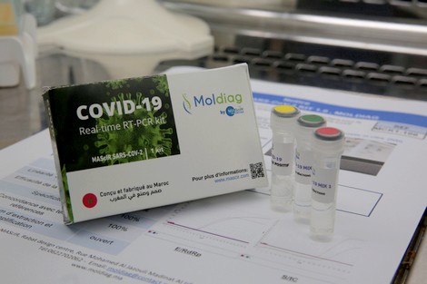 صورة إنجاز غير مسبوق سيفرح المغاربة.. المغرب يُطور اختبارا تشخيصيا لفيروس “كورونا”