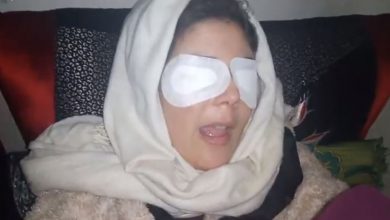 صورة شابة جميلة مشاو ليها عينيها ومول الفعلة قـــ__تل راسو في مكناس