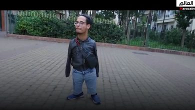 صورة بدون يدين ولقبوه بالكائن الغريب.. لكن تحداهم ونجح في البكالوريا والآن يدرس علم النفس في الكلية